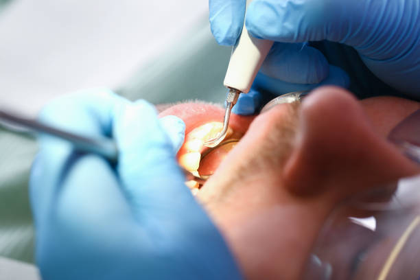 Best Emergency Treatment for Toothache in Goodman, MS